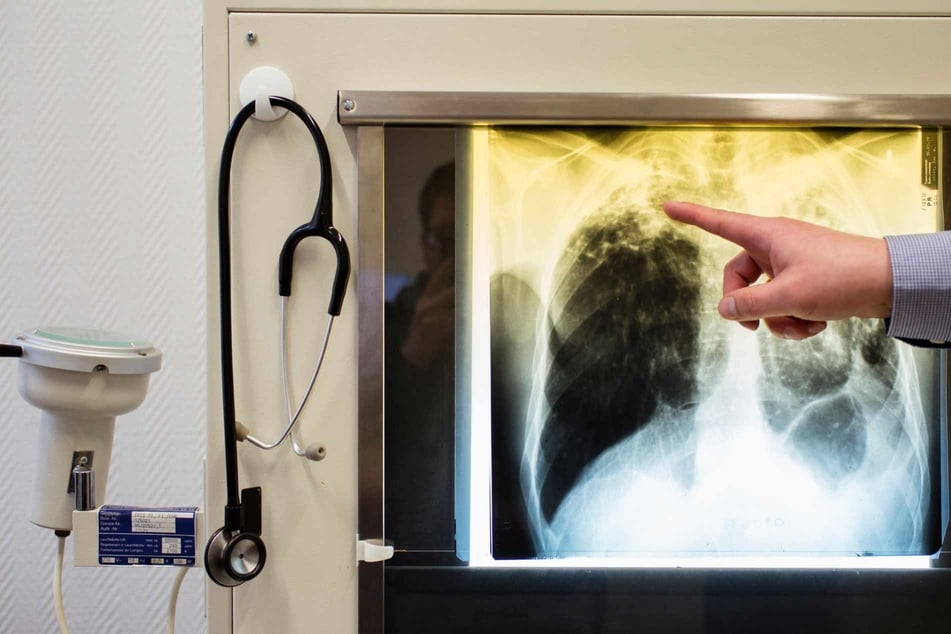 Dresden: Stadt-Update blieb aus: Was ist nach dem TBC-Alarm an zwei Dresdner Schulen passiert?