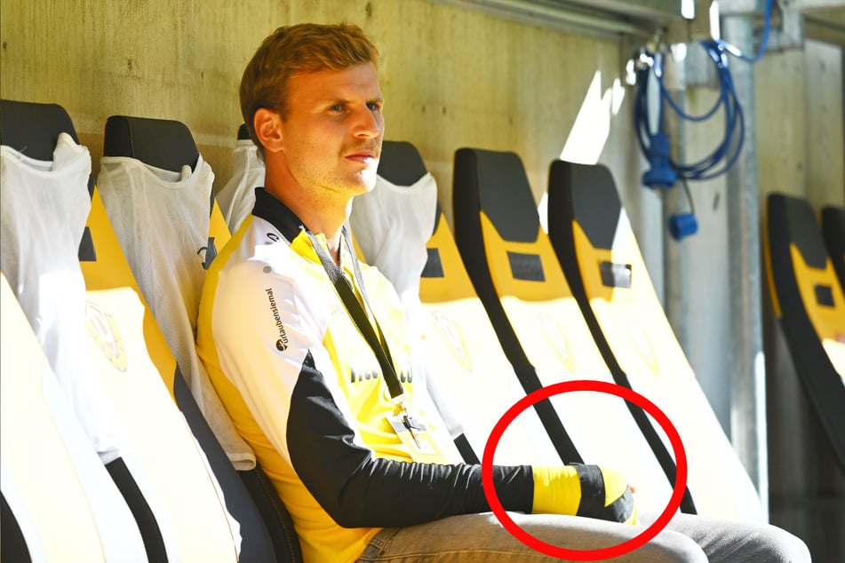 Christoph Daferner trägt eine Gipseverband an der Rechten Hand.