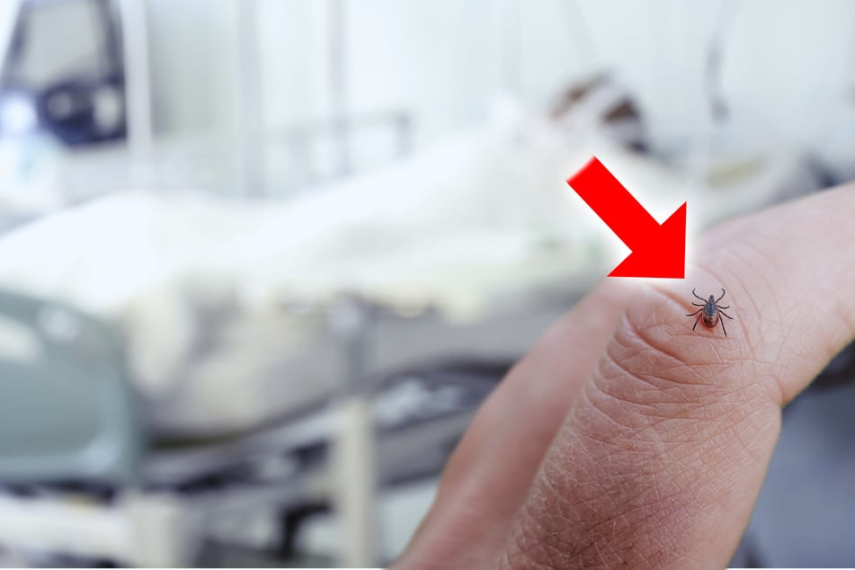 "Potenziell tödlich": Gefährliche Zecken-Infektion wieder aufgetaucht