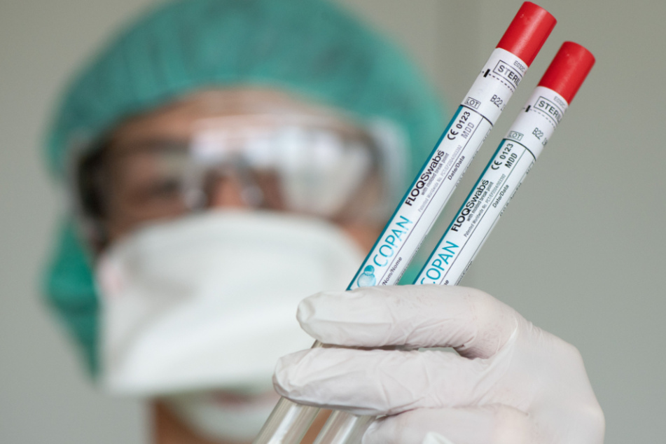 Das Virus breitet sich immer mehr aus. Nun ist ein weiterer Todesfall zu beklagen. (Symbolbild)