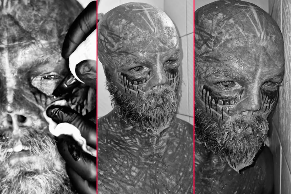 Anthony "Black Alien" Loffredo has a new addition to his radical selection of body modifications and tattoos.